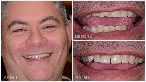 James, who's an actual patient of NorthStar Dentistry for Adults and is now in our Smile Gallery